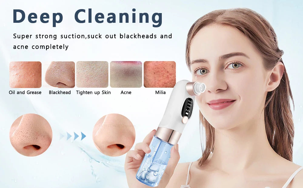 Blackhead Remover Vacuum — Electric Pore Cleaner USB Rechargeable Water Cycle Face Cleanser