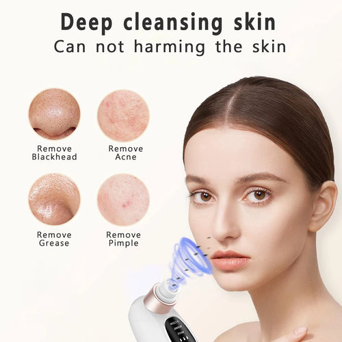 Blackhead Remover Vacuum — Electric Pore Cleaner USB Rechargeable Water Cycle Face Cleanser