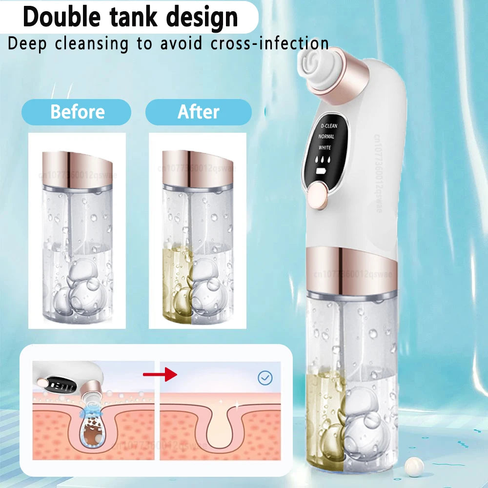 Blackhead Remover Vacuum — Electric Pore Cleaner USB Rechargeable Water Cycle Face Cleanser