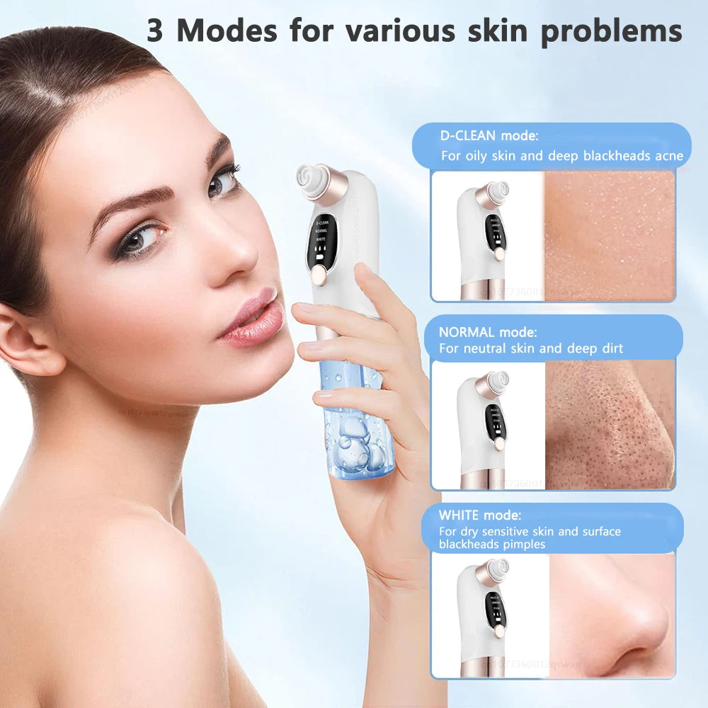 Blackhead Remover Vacuum — Electric Pore Cleaner USB Rechargeable Water Cycle Face Cleanser