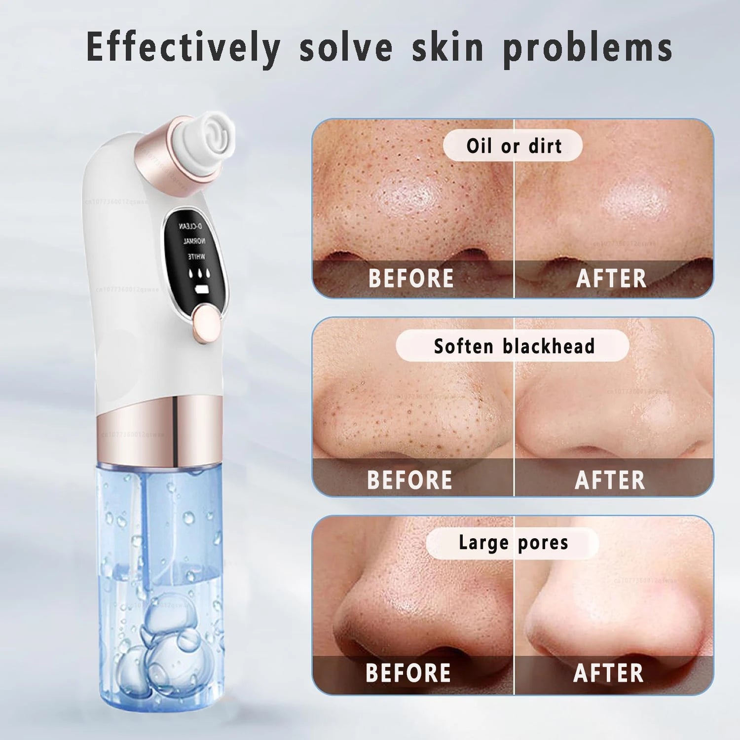 Blackhead Remover Vacuum — Electric Pore Cleaner USB Rechargeable Water Cycle Face Cleanser