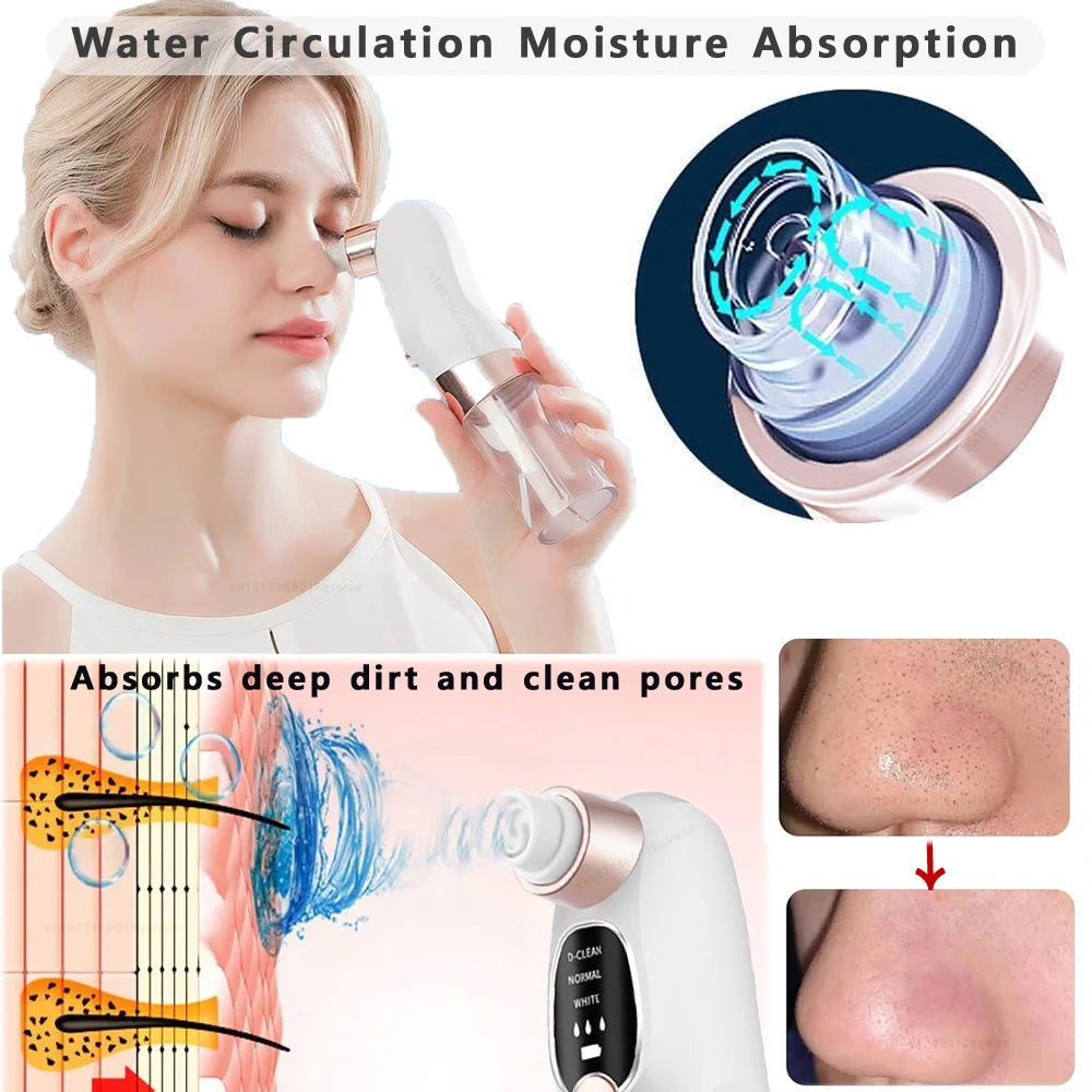 Blackhead Remover Vacuum — Electric Pore Cleaner USB Rechargeable Water Cycle Face Cleanser
